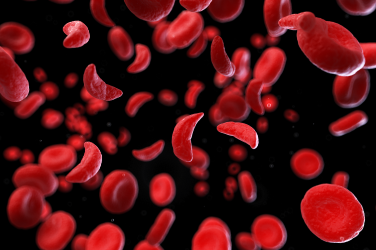 Sickle Cell Awareness Day: Why Fathers Need to Know What Is in Their Blood
